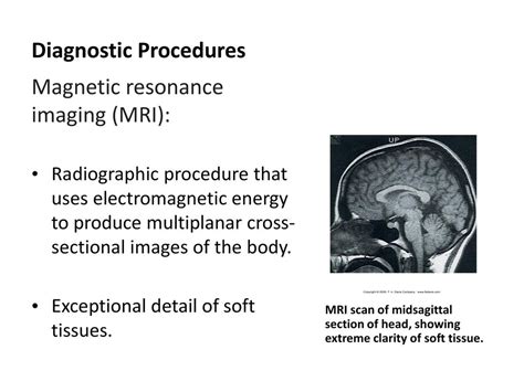 this test uses magnetic waves to show soft tissue lesions|magnetic resonance imaging procedures.